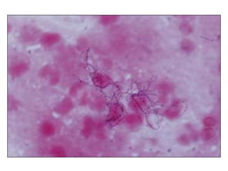 Introduction to Infectious Diseases and Bacterial Infections | PPTX