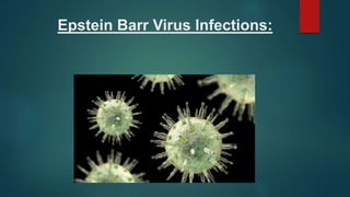 Epstein Barr Virus Infections:
 