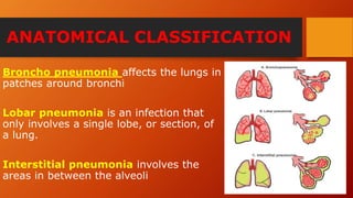 ANATOMICAL CLASSIFICATION
Broncho pneumonia affects the lungs in
patches around bronchi
Lobar pneumonia is an infection that
only involves a single lobe, or section, of
a lung.
Interstitial pneumonia involves the
areas in between the alveoli
 