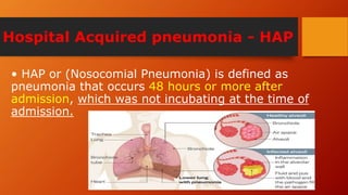 Hospital Acquired pneumonia - HAP
• HAP or (Nosocomial Pneumonia) is defined as
pneumonia that occurs 48 hours or more after
admission, which was not incubating at the time of
admission.
 