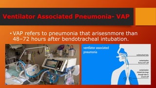 Ventilator Associated Pneumonia- VAP
• VAP refers to pneumonia that arisesnmore than
48–72 hours after bendotracheal intubation.
 