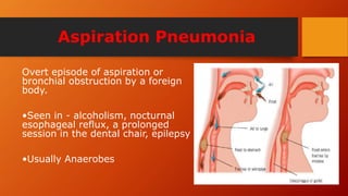 Aspiration Pneumonia
Overt episode of aspiration or
bronchial obstruction by a foreign
body.
•Seen in - alcoholism, nocturnal
esophageal reflux, a prolonged
session in the dental chair, epilepsy
•Usually Anaerobes
 