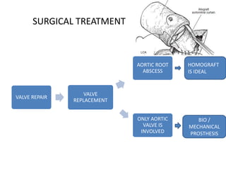 SURGICAL TREATMENT
VALVE REPAIR
VALVE
REPLACEMENT
AORTIC ROOT
ABSCESS
ONLY AORTIC
VALVE IS
INVOLVED
HOMOGRAFT
IS IDEAL
BIO /
MECHANICAL
PROSTHESIS
 