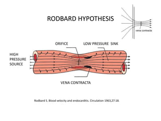 RODBARD HYPOTHESIS
ORIFICE LOW PRESSURE SINK
HIGH
PRESSURE
SOURCE
VENA CONTRACTA
Rodbard S. Blood velocity and endocarditis. Circulation 1963,27:18.
 