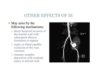 OTHER EFFECTS OF IE
 May arise by the
following mechanisms:
 direct bacterial invasion of
the arterial wall with
subsequent abscess
formation or rupture
 septic or bland emoblic
occlusion of the vasa
vasorum
 immune complex
deposition with resultant
injury to arterial wall
 