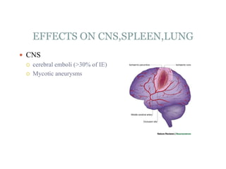 EFFECTS ON CNS,SPLEEN,LUNG
 CNS
 cerebral emboli (>30% of IE)
 Mycotic aneurysms
 