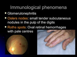 Immunological phenomenaImmunological phenomena
 GlomerulonephritisGlomerulonephritis
 Oslers nodesOslers nodes: small tender subcutaneous: small tender subcutaneous
nodules in the pulp of the digitsnodules in the pulp of the digits
 Roths spotsRoths spots: Oval retinal hemorrhages: Oval retinal hemorrhages
with pale centreswith pale centres
 