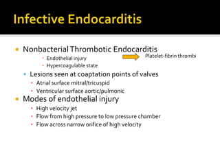  NonbacterialThrombotic Endocarditis
 Endothelial injury
 Hypercoagulable state
 Lesions seen at coaptation points of valves
▪ Atrial surface mitral/tricuspid
▪ Ventricular surface aortic/pulmonic
 Modes of endothelial injury
▪ High velocity jet
▪ Flow from high pressure to low pressure chamber
▪ Flow across narrow orifice of high velocity
Platelet-fibrin thrombi
 