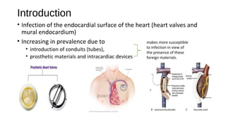 Introduction
• Infection of the endocardial surface of the heart (heart valves and
mural endocardium)
• Increasing in prevalence due to
• introduction of conduits (tubes),
• prosthetic materials and intracardiac devices
makes more susceptible
to infection in view of
the presence of these
foreign materials.
 