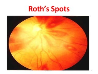 Roth’s Spots
7/29/2019 22
 
