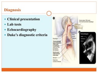 Diagnosis
 Clinical presentation
 Lab tests
 Echocardiography
 Duke’s diagnostic criteria
 