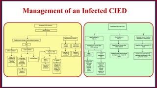 Infective Endocarditis | PDF
