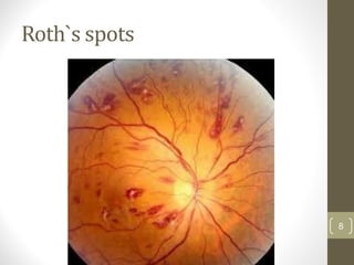 Roth`s spots
8
 
