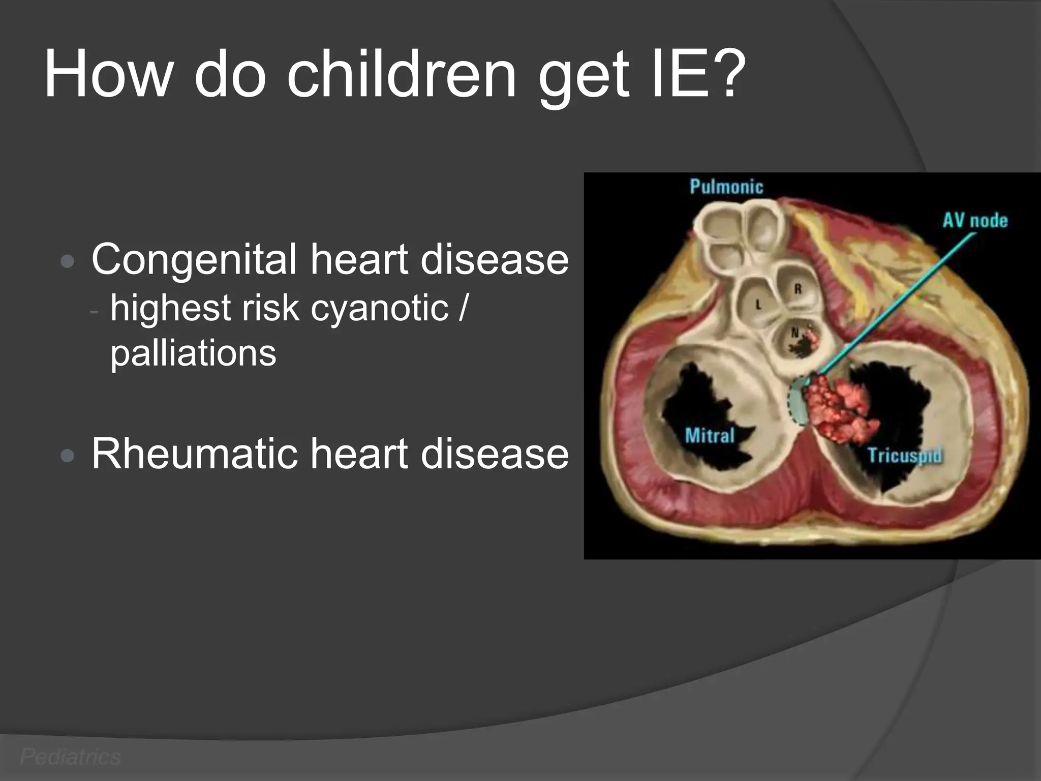 Endocarditis Animation Infective Endocarditis.ppt