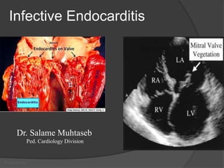 Pediatrics
Infective Endocarditis
Dr. Salame Muhtaseb
Ped. Cardiology Division
 