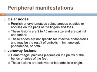 Peripheral manifestations
 Osler nodes:
 Purplish or erythematous subcutaneous papules or
nodules on the pads of the fingers and toes.
 These lesions are 2 to 15 mm in size and are painful
and tender.
 These nodes are not specific for infective endocarditis
and may be the result of embolism, immunologic
phenomena, or both.
 Janeway lesions:
 Hemorrhagic, painless plaques on the palms of the
hands or soles of the feet.
 These lesions are believed to be embolic in origin.
13
 