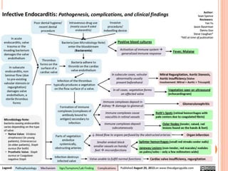 Infective endocarditis