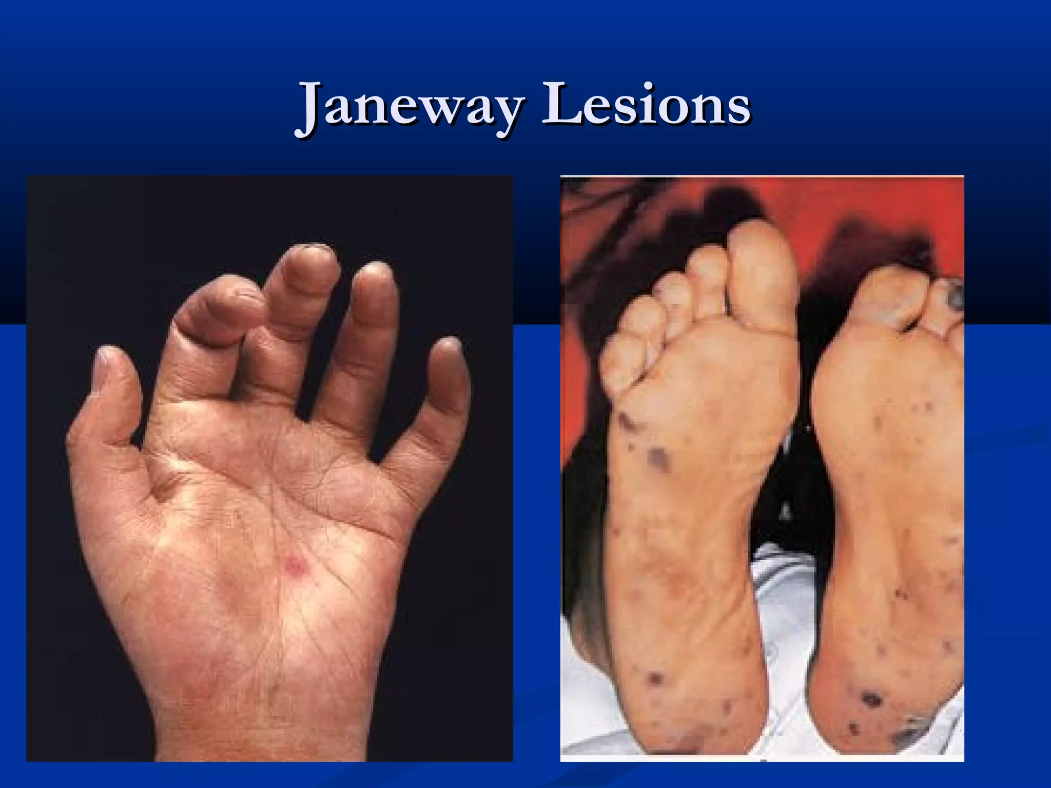 JJaanneewwaayy LLeessiioonnss 
 