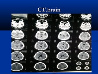 CCTT..bbrraaiinn 
44 
 