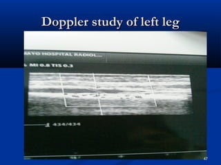 DDoopppplleerr ssttuuddyy ooff lleefftt lleegg 
47 
 