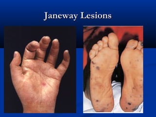 JJaanneewwaayy LLeessiioonnss 
 