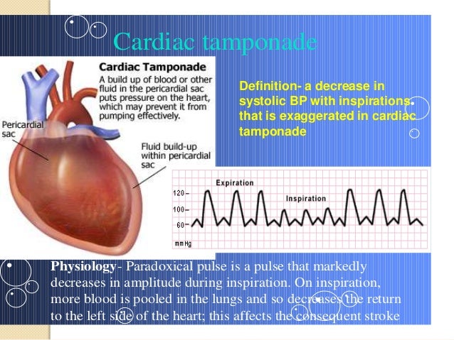 Indocin Dose For Pericarditis