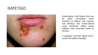 Diffuse Impetigo Rash INFECTIVE SYNDROMES best best OF SKIN.pptx