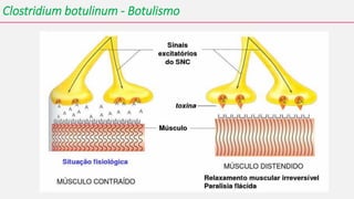 Clostridium botulinum - Botulismo
 
