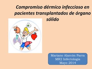 Compromiso dérmico infeccioso en
pacientes transplantados de órgano
sólido
Mariano Alarcón Parra
MR2 Infectología
Mayo 2014
 