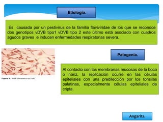 Etiología.
Es causada por un pestivirus de la familia flaviviridae de los que se reconoce
dos genotipos vDVB tipo1 vDVB tipo 2 este último está asociado con cuadros
agudos graves e inducen enfermedades respiratorias severa.
Patogenia.
Al contacto con las membranas mucosas de la boca
o nariz, la replicación ocurre en las células
epiteliales con una predilección por los tonsilas
palatinas, especialmente células epiteliales de
cripta.
Angarita.
 