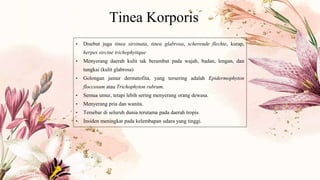 Tinea Korporis
• Disebut juga tinea sirsinata, tinea glabrosa, scherende flechte, kurap,
herpes sircine trichophytique
• Menyerang daerah kulit tak berambut pada wajah, badan, lengan, dan
tungkai (kulit glabrosa)
• Golongan jamur dermatofita, yang tersering adalah Epidermophyton
floccosum atau Trichophyton rubrum.
• Semua umur, tetapi lebih sering menyerang orang dewasa.
• Menyerang pria dan wanita.
• Tersebar di seluruh dunia terutama pada daerah tropis.
• Insiden meningkat pada kelembapan udara yang tinggi.
 