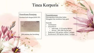 Tinea Korporis
Pemeriksaan Penunjang
Kerokan kulit dengan KOH 10%
Hifa panjang dan bercabang
Penatalaksanaan
Meningkatkan kebersihan badan.
Mengganti dan membawa baju ganti
Sistemik:
• Antihistamin
• Griseofulvin:
• anak-anak: 15-20 mg/kg BB/hari.
• dewasa : 500-1000 mg per hari.
• Itrakonazol 100 mg/hari selama 2 minggu
• Ketokonazol 200 mg/hari dalam 3 minggu
 