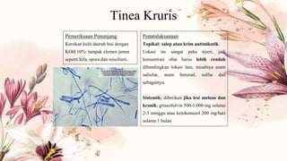 Tinea Kruris
Pemeriksaan Penunjang
Kerokan kulit daerah lesi dengan
KOH 10%: tampak elemen jamur
seperti hifa, spora dan miselium.
Penatalaksanaan
Topikal: salep atau krim antimikotik.
Lokasi ini sangat peka nyeri, jadi
konsentrasi obat harus lebih rendah
dibandingkan lokasi lain, misalnya asam
salisilat, asam benzoal, sulfur dan
sebagainya.
Sistemik: diberikan jika lesi meluas dan
kronik; griseofulvin 500-1.000 mg selama
2-3 minggu atau ketokonazol 200 mg/hari
selama 1 bulan
 
