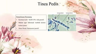 Tinea Pedis
Pemeriksaan Penunjang
• Kerokan kulit + KOH 10%: hifa positif.
• Biakan agar Saboraud: tumbuh koloni-
koloni jamur.
• Sinar Wood: fluoresensi positif.
 