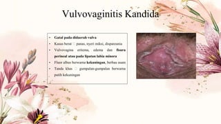 Vulvovaginitis Kandida
• Gatal pada didaerah vulva
• Kasus berat 🡪 panas, nyeri miksi, dispareunia
• Vulvovagina eritema, edema dan fisura
perineal atau pada lipatan labia minora
• Fluor albus berwarna kekuningan, berbau asam
• Tanda khas 🡪 gumpalan-gumpalan berwarna
putih kekuningan
 