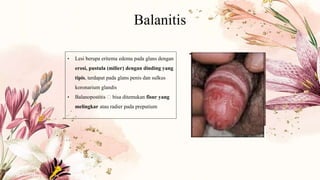 Balanitis
• Lesi berupa eritema edema pada glans dengan
erosi, pustula (milier) dengan dinding yang
tipis, terdapat pada glans penis dan sulkus
koronarium glandis
• Balanopostitis 🡪 bisa ditemukan fisur yang
melingkar atau radier pada preputium
 