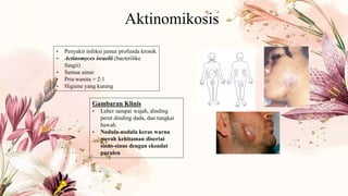 Aktinomikosis
• Penyakit infeksi jamur profunda kronik
• Actinomyces israelii (bacterilike
fungii)
• Semua umur
• Pria:wanita = 2:1
• Higiene yang kurang
Gambaran Klinis
• Leher sampai wajah, dinding
perut dinding dada, dan tungkai
bawah.
• Nodula-nodula keras warna
merah kehitaman disertai
sinus-sinus dengan eksudat
purulen
 