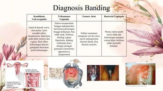 Kandidosis
Vulvovaginitis
Trikomonas
Vaginalis
Gonore Akut Bacterial Vaginosis
Gatal di daerah vulva,
rasa panas, nyeri
sesudah miksi,
dyspareunia, hiperemis
pada labia minora dan
vagina, fluor albus
kekuningan disertai
gumpalan berwarna
putih kekuningan
Sekret seropurulent
hingga mukopurulen
berwarna kekuningan
hingga kehijauan, bau
tidak enak, berbusa,
dinding vagina
hiperemis, kadang
terbentuk abses
sebagai jaringan
granulasi (strawberry
appearance),
dyspareunia
Infeksi umumnya
mengenai serviks uteri,
secret mukopurulen
disertai darah, bisa
disertai uretritis
Warna sekret putih
kotor tidak ada
kekuningan ataupun
warna hijau, berbusa
tidak memiliki
keluhan.
Diagnosis Banding
 