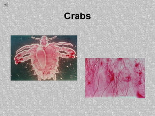 Crabs
 