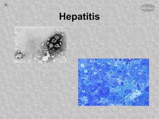 Hepatitis
IMS Umum
 