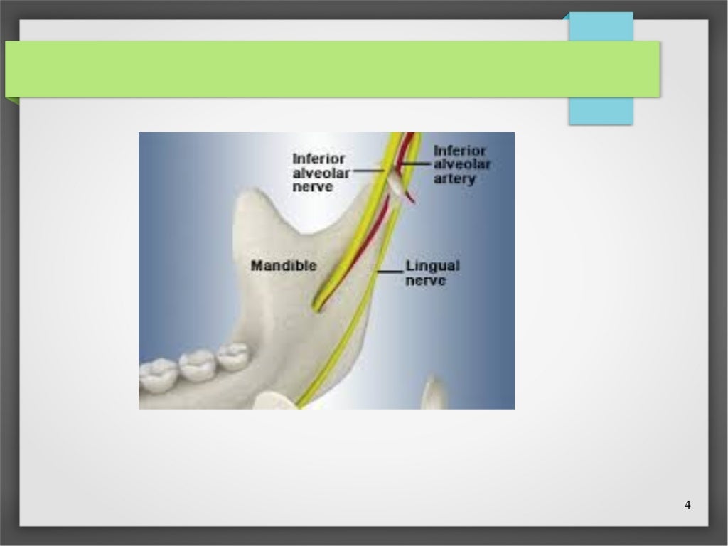 Inferior alveolar nerve block