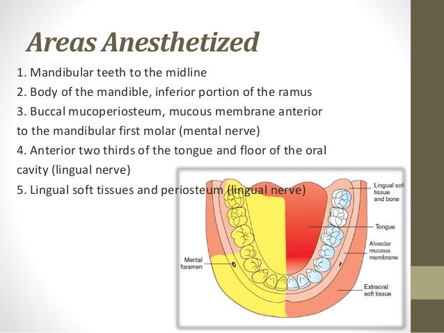 inferior alveolar nerve block