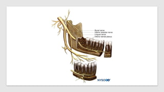 Inferior Alveolar Nerve Block.pptx