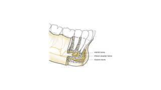 Inferior Alveolar Nerve Block.pptx