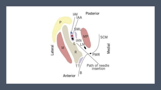 Inferior Alveolar Nerve Block.pptx
