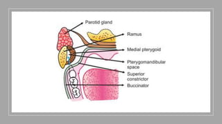 Inferior Alveolar Nerve Block.pptx