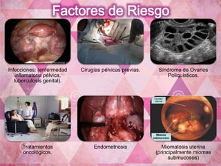 Infecciones: (enfermedad 
inflamatoria pélvica, 
tuberculosis genital). 
Cirugías pélvicas previas. Síndrome de Ovarios 
Poliquísticos. 
Tratamientos 
oncológicos. 
Endometriosis Miomatosis uterina 
(principalmente miomas 
submucosos) 
 