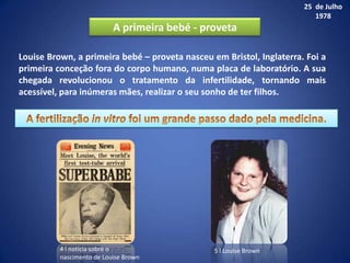 25 de Julho
                                                                         1978
                           A primeira bebé - proveta

Louise Brown, a primeira bebé – proveta nasceu em Bristol, Inglaterra. Foi a
primeira conceção fora do corpo humano, numa placa de laboratório. A sua
chegada revolucionou o tratamento da infertilidade, tornando mais
acessível, para inúmeras mães, realizar o seu sonho de ter filhos.




          4 l notícia sobre o                   5 l Louise Brown
          nascimento de Louise Brown
 