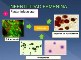 Factor Infeccioso:
6.
C. trachomatis
Especies de Mycoplasma
Ureaplasma
Citología
 