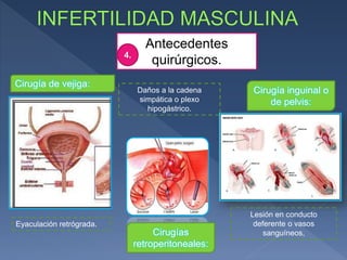 Antecedentes
quirúrgicos.4.
Cirugía de vejiga:
Cirugías
retroperitoneales:
Cirugía inguinal o
de pelvis:
Eyaculación retrógrada.
Daños a la cadena
simpática o plexo
hipogástrico.
Lesión en conducto
deferente o vasos
sanguíneos,
 